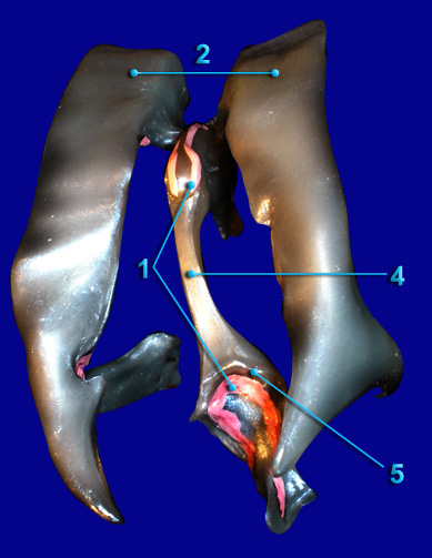 Cerebral Ventricles - Posterior View