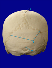 Posterior Sutures