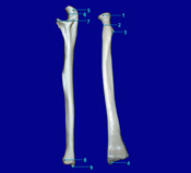 Ulna Radius