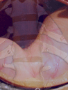 Stomach - Digestive System